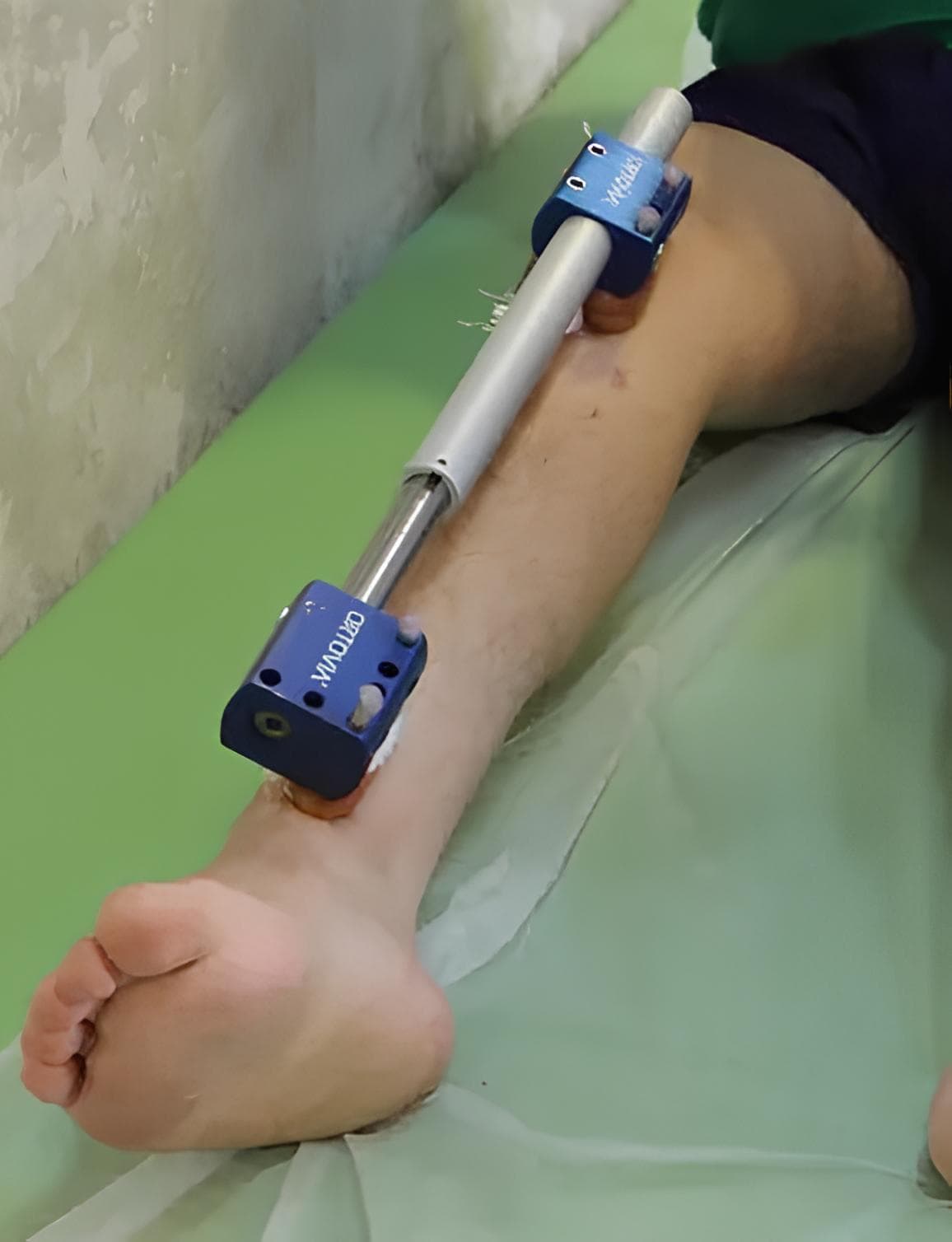 International Limb Lengthening Center of IRAN — clinic photo — photo 3