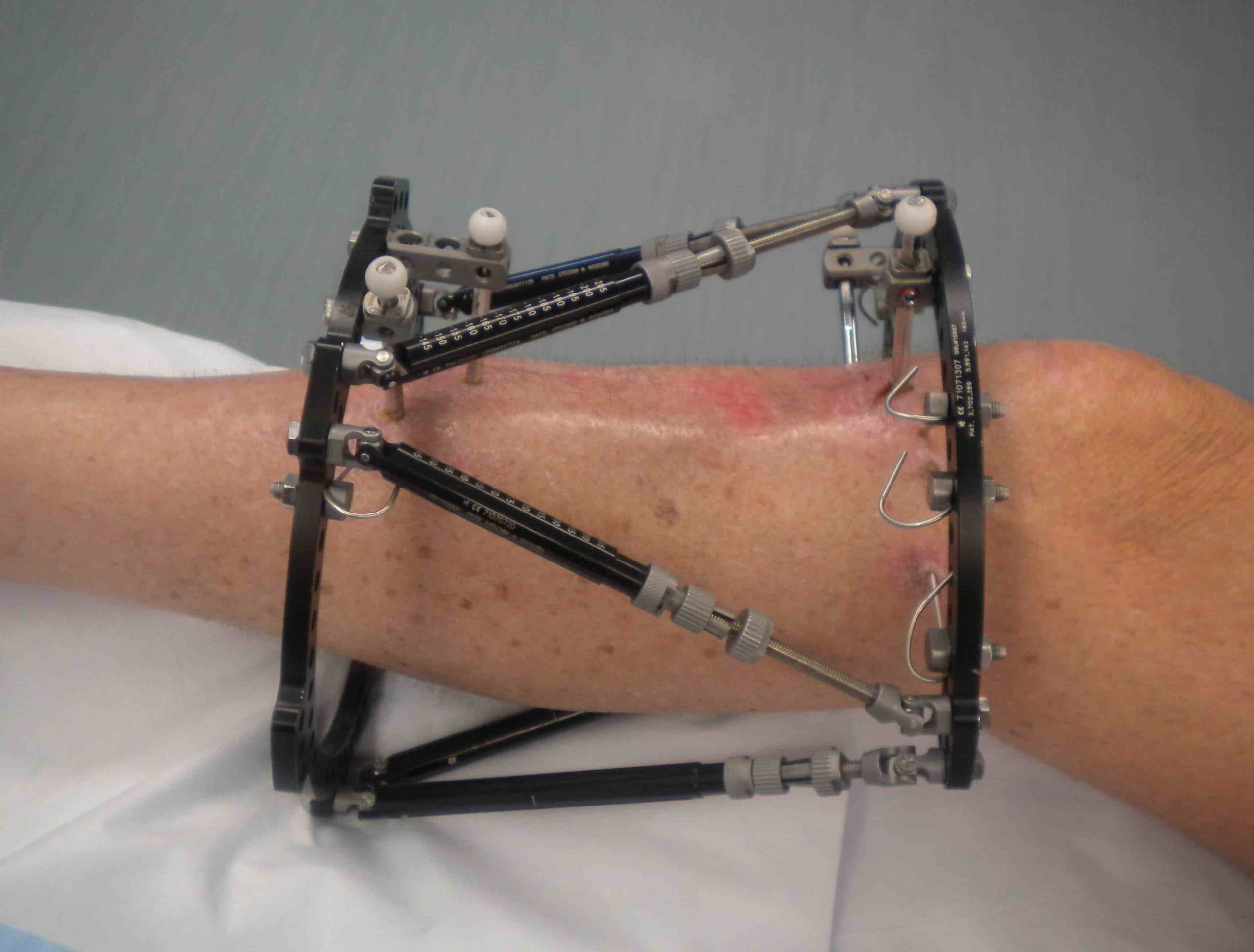 Limb Reconstruction Unit — clinic photo — photo 3