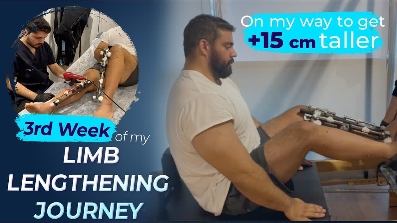 3rd week of my Limb Lengthening Journey | On my way to get ...