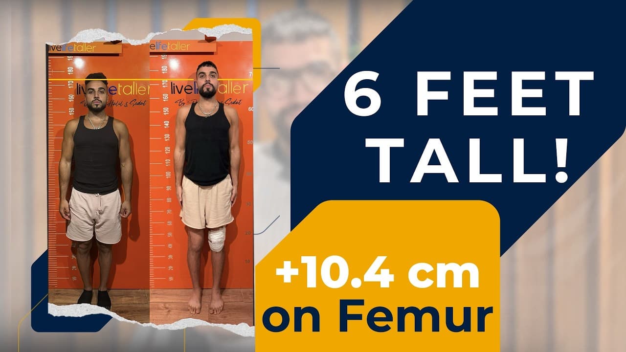 6 FEET TALLER WITH LIMB LENGTHENING SURGERY - YouTube